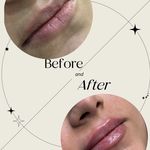 کلینیک زیبایی لاغری لیزر دانا