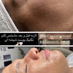 خدمات فیشال ،پاکسازی ندادمیرچی کلینیکBKD