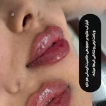 کلینیک زیبایی و جوانسازی پوست و مو الین