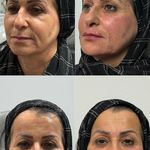 کلینیک زیبایی و جوانسازی پوست و مو الین