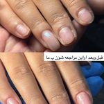 خدمات ناخن کاشت،ترمیم،لمینت شادی رسولپور