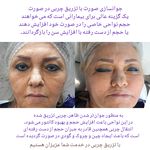 مركز ليزر و مطب زيبايی دكتر محمودآبادی