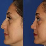 کلینیک زیبایی الماس کاملا اقساطی