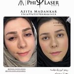 خدمات تخصصی ریمو تتو آزیتا