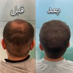 کلینیک پوست، مو، لیزر آنست