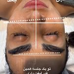 خدمات فیشال ،پاکسازی ندادمیرچی کلینیکBKD