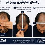 پروتز مو دکتر کات