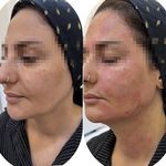 کلینیک تخصصی ژل و بوتاکس مرضیه آقابابایی