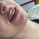 کلینیک لیزر  کندلاوزیبایی پوست ومو آیشیل