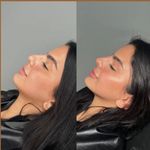 کلینیک پوست و زیبایی ژیلاوَش