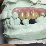 دندانسازی..پروتزیست اسماعیل فرجامی