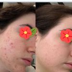 انجام خدمات پاک پوست و فیشیال
