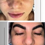 خدمات تخصصی فیشال و پاکسازی پوست صبا