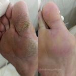 پدیکورتخصصی شهره