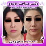 دکترمیراحدموسوی