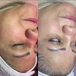 خدمات تخصصی فیشیال آیسو