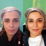 کلینیک زیبایی پارسیان آلفا