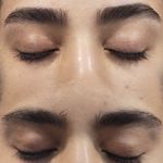 اصلاح تخصصی وترمیمی ابروی فرزانه