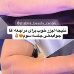 مطب پوست، مو و زیبایی و لیزر شبیرا