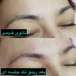 مركز تخصصي ابرو زرکاشت