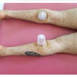 طب سنتی عامری (حجامت و بادکش)
