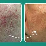 کلینیک زیبایی و لیزر لوتوس