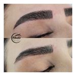 خدمات تخصصی ابرو حدیث معصومی