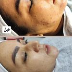 فیشال تخصصی پوست اسپا بیوتی