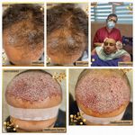 کلینیک زیبایی پوست و مو آتریسا