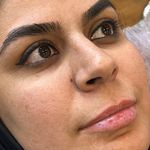 کلینیک پوست سلین - کلینیک پوست و مو - شهر شیراز - 0030