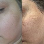 خدمات فیشیال پوست و ماساژ صورت و بدن