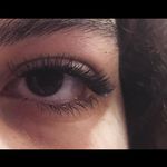 کاشت مژه پارسافر