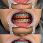 مطب دندانپزشکی دکتر پیمان رستمیان