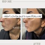 مرکز لیزر ،پوست و زیبایی کندی بیوتی