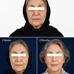 مرکز تخصصی زیبایی و لیزر دمور