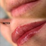 خدمات تخصصی تتو پرشین