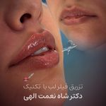 پوست مو فیلر جوانساز دکتر شاه نعمت الهی