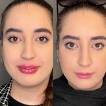 کلینیک پوست  و مو موتاکس