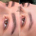 میکروبلیدینگ رویا