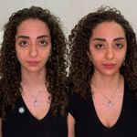 كلينيک زیبایی سانيل