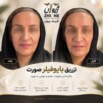 مرکز پی آر پی تهران