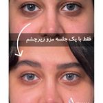 مجموعه زیبایی آتیماه