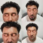 کلینیک پوست مو لیزر و لاغری عصر زیبایی