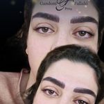 آرایش دائم وریموو تراپی پوست گندم فلاحی