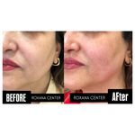 کلینیک پوست مو و زیبایی رکسانا