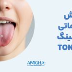 امیقا پیرسینگ تهران