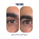 کلینیک زیبایی مهر