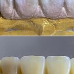 لابراتوار دندانسازی شیمی