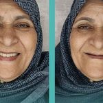 لابراتوار دندانسازی روشَنا
