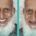 لابراتوار دندانسازی روشَنا